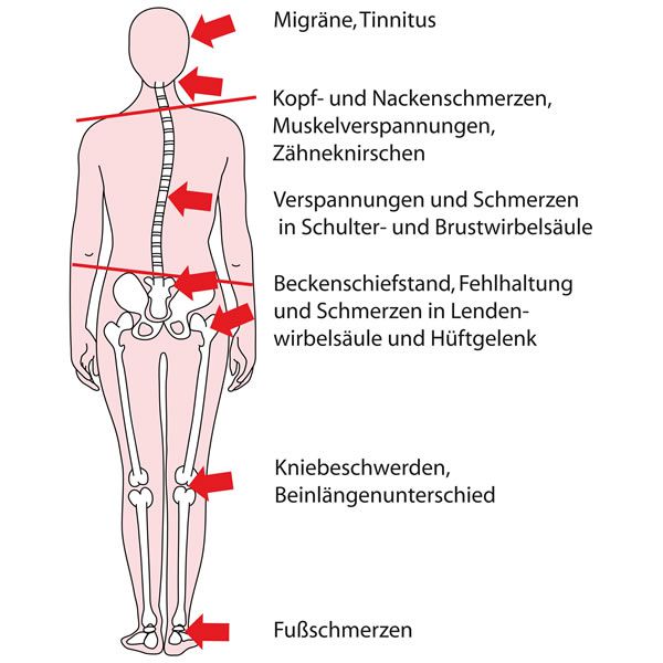 CMD / Funktionsdiagnostik